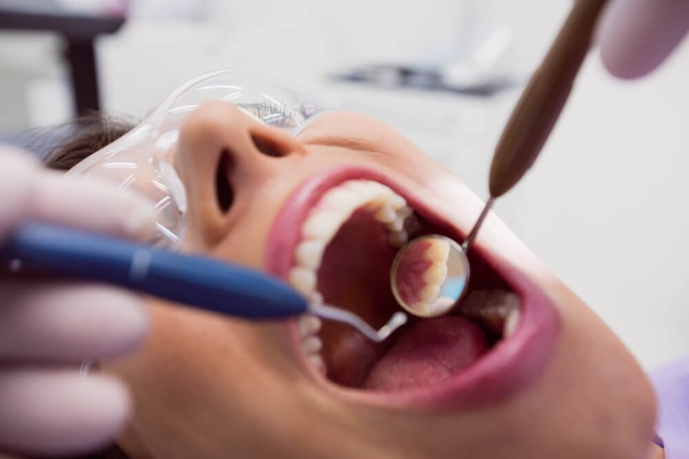 Endodoncia: El tratamiento clave para salvar un diente dañado